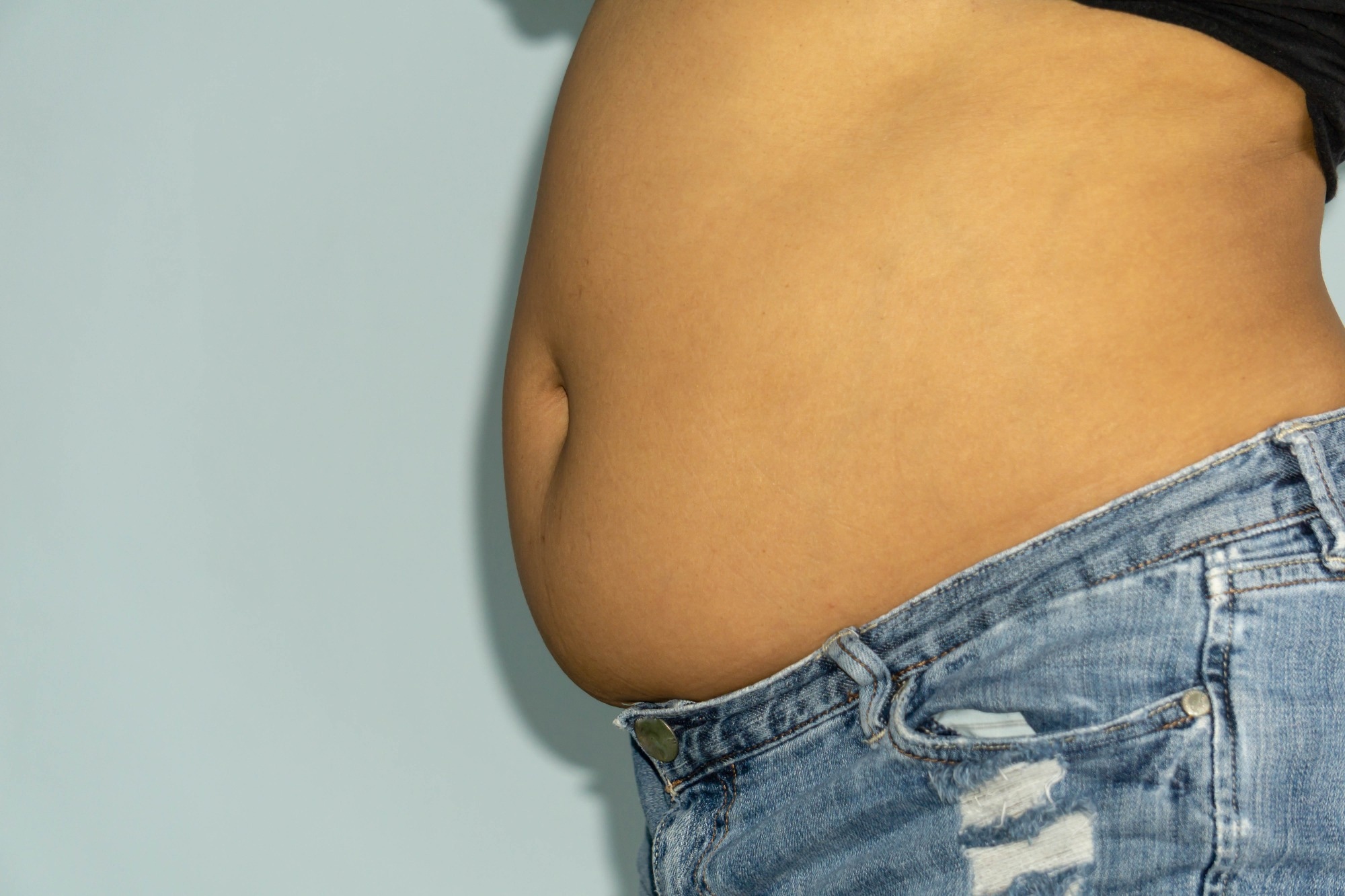 Bloated abdomen caused by abdominal fluid buildup
