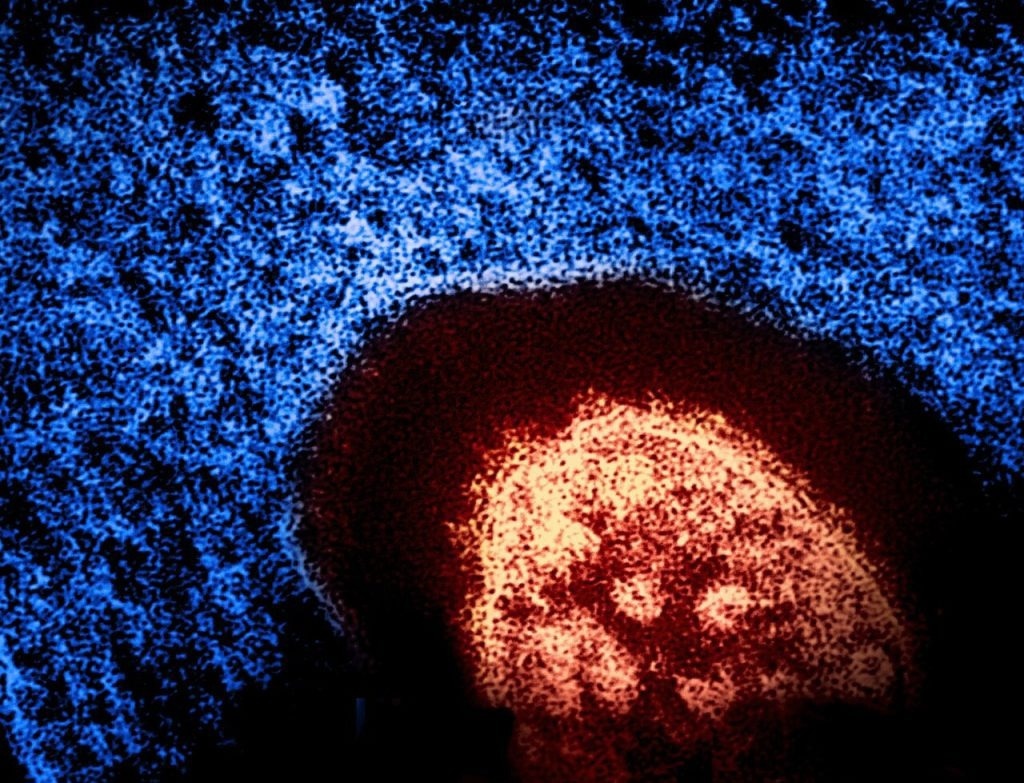 Scientists Decode How T Cells Stop Deadly Viruses