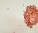 Bispecific Antibodies Target Tumors While Sparing Healthy Tissue