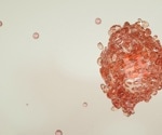 Bispecific Antibodies Target Tumors While Sparing Healthy Tissue