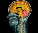 Drug Boosts Axon Regrowth In Human Brain-Spinal Cord Model