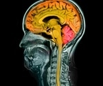 Drug Boosts Axon Regrowth In Human Brain-Spinal Cord Model
