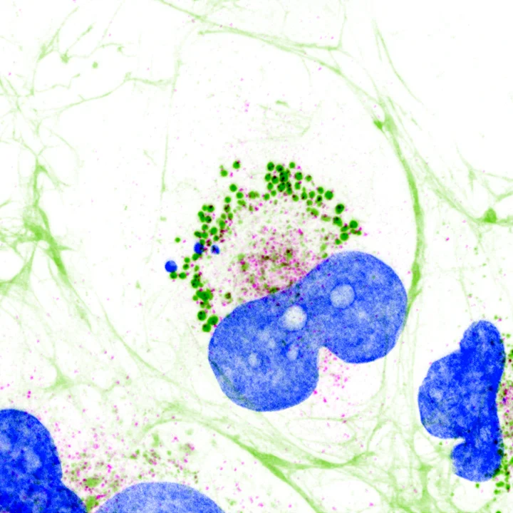 New Liquid Extrusion Hypothesis Explains How Large Collagen Molecules Exit Cells
