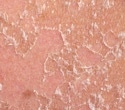 New Study Reveals How Skin Immune Cells Shape Long-Term Health