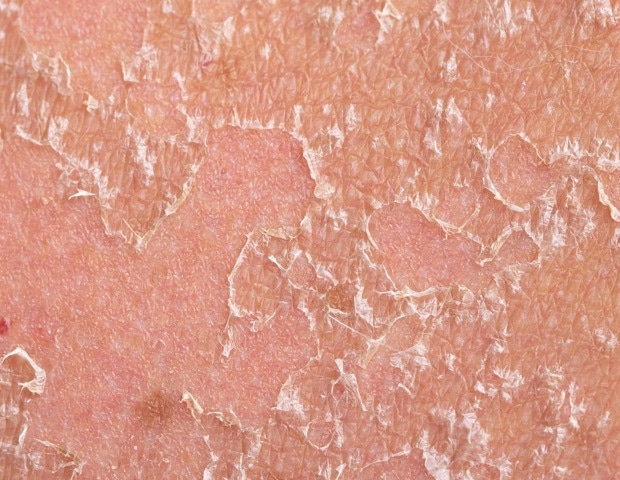 New Study Reveals How Skin Immune Cells Shape Long-Term Health