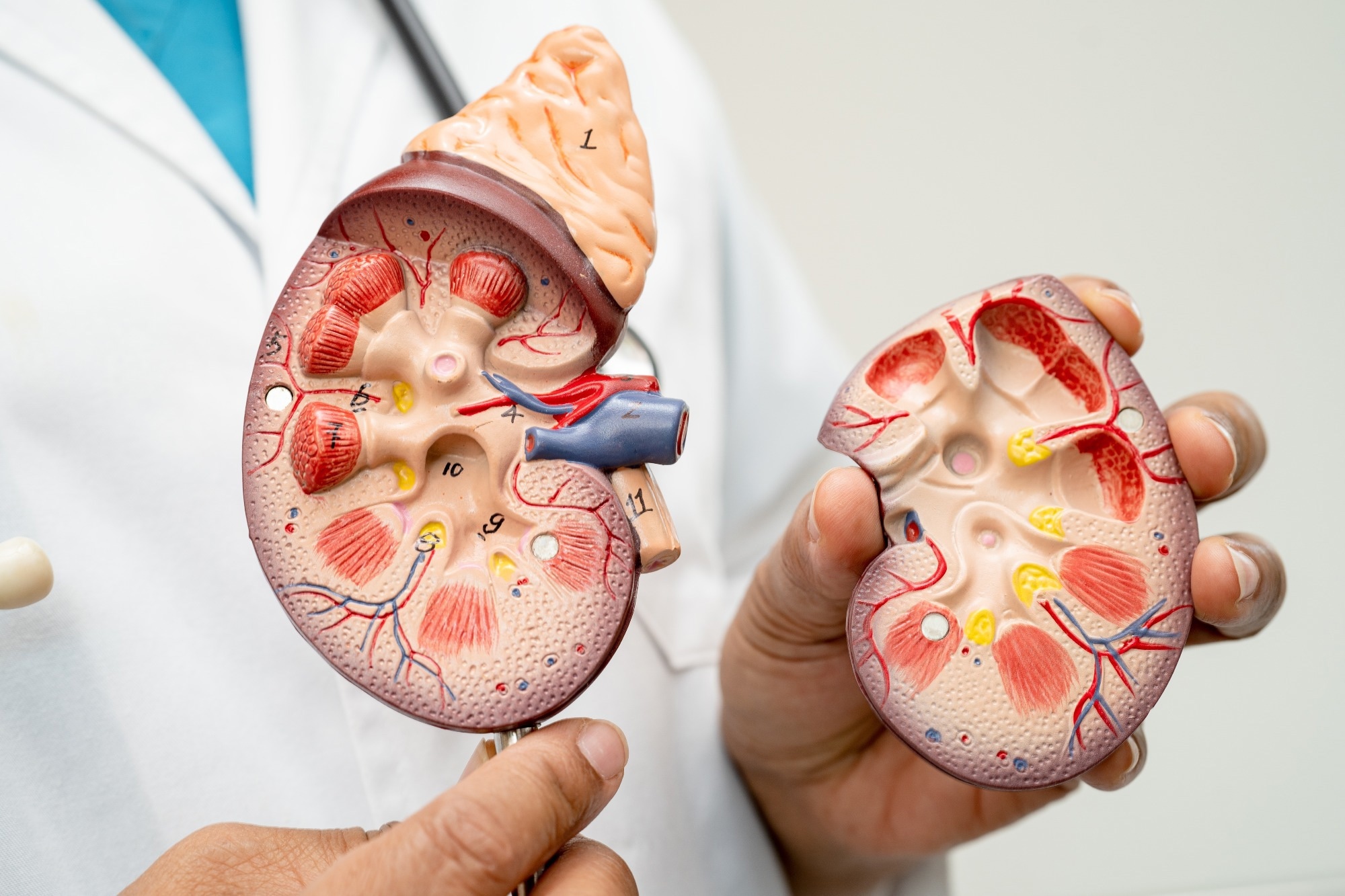 Kidney disease, Chronic kidney disease ckd, Doctor with human model to study and treat in hospital.