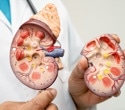 Synthetic Organizer Cells To Build More Realistic Kidney Organoids
