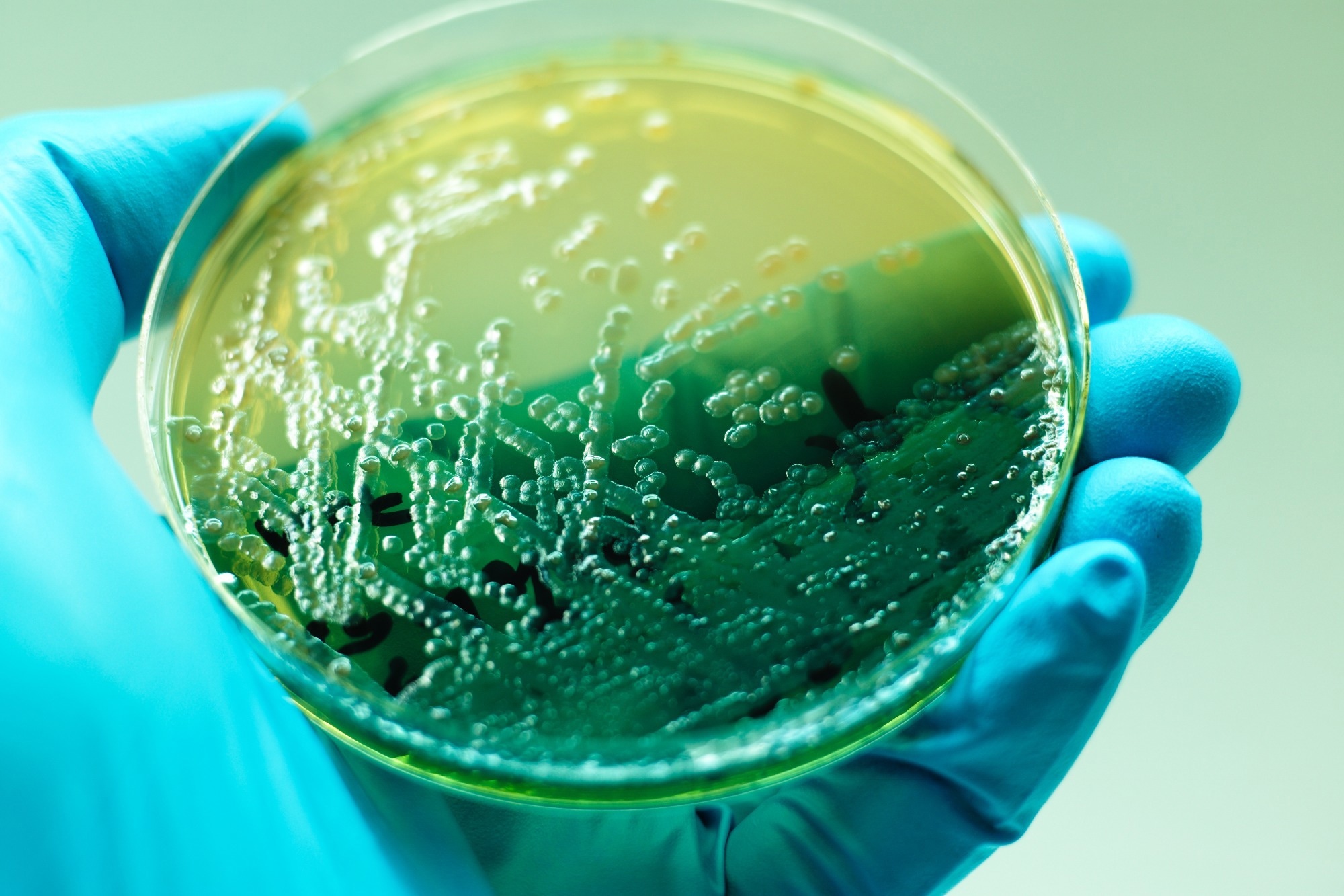 Pseudomonas aeruginosa colonies as test on MacConkey agar plate contains small light grains. Focus on all agar surface  in experimental laboratory  Hospital white background