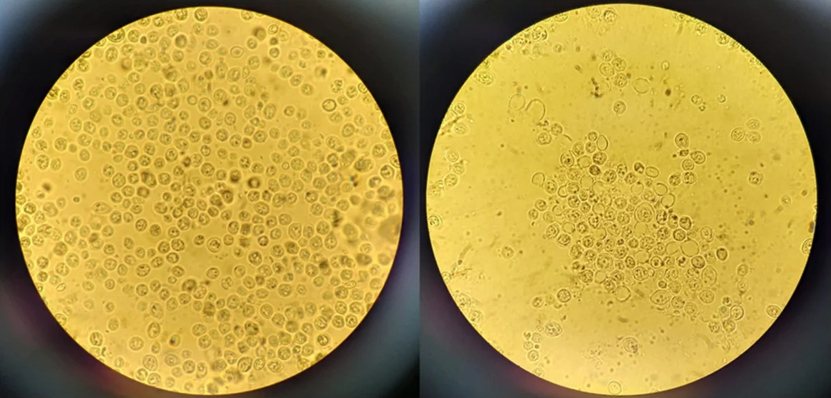 Optical microscope images (100×) of yeast cells before and after the sonication for the squalene extraction. Cell lysis, as evidenced by cell wall breakdown and cellular aggregation, releases squalene into the extracellular environment.