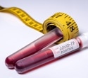 GLP-1 Drugs Show Promise Against Long COVID-Related Lung Scarring