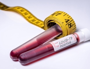 GLP-1 Drugs Show Promise Against Long COVID-Related Lung Scarring