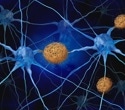 Arc Protein Identified as Driving Tau Spread in Alzheimer's Disease