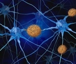 Arc Protein Identified as Driving Tau Spread in Alzheimer's Disease