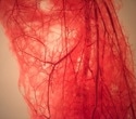 MIT Researchers Grow Blood Vessels by Stretching Them