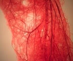 MIT Researchers Grow Blood Vessels by Stretching Them