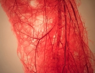 MIT Researchers Grow Blood Vessels by Stretching Them