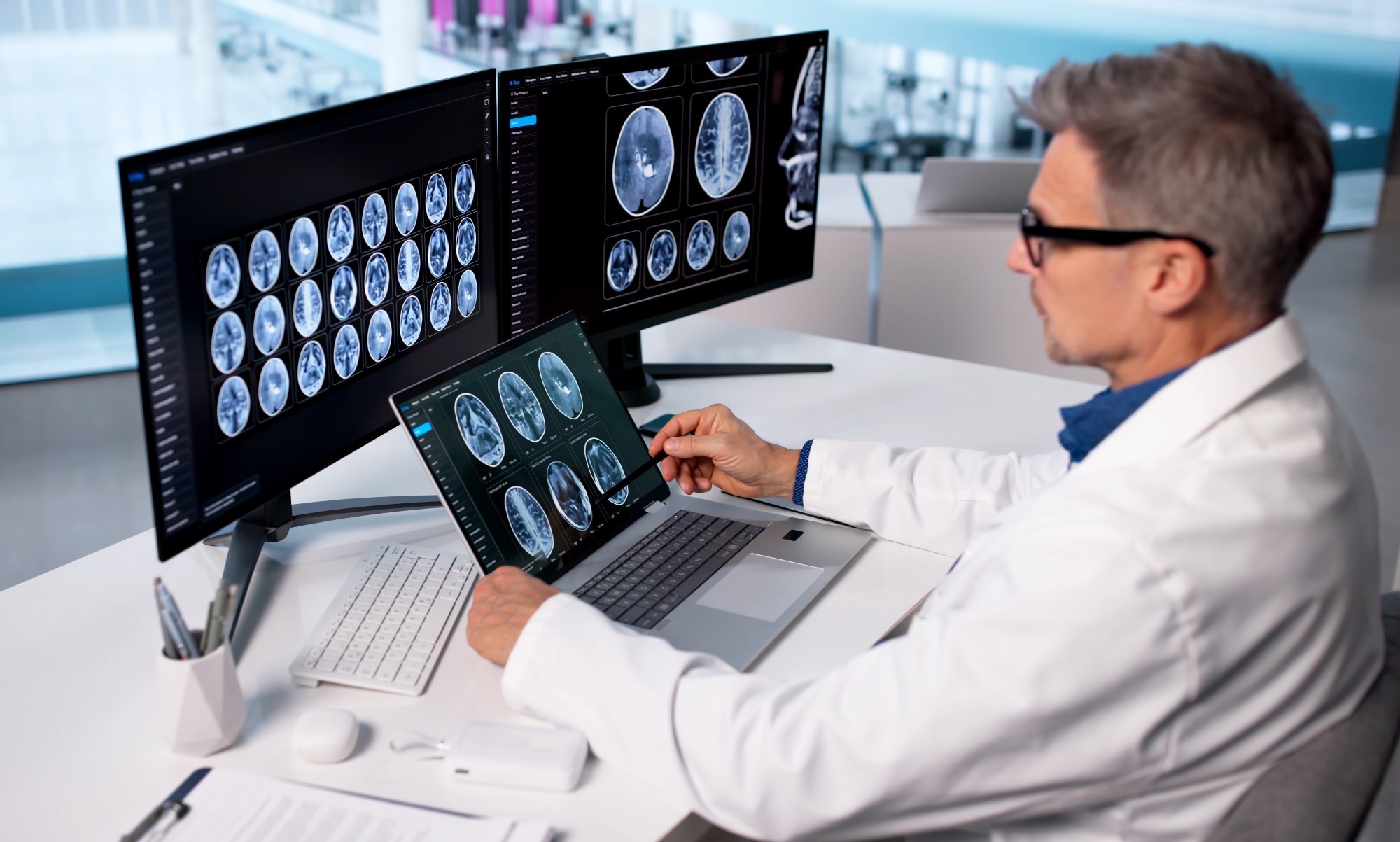 Diverse Medical Team Analyzing Brain Scans On Computer Screens In Clinic.
