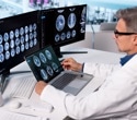 Hospital-Trained AI Outperforms GPT-5 At Reading Brain Scans