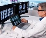Hospital-Trained AI Outperforms GPT-5 At Reading Brain Scans