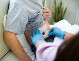 A Bio-Based Janus Dressing That Targets Bacteria At Wound Sites