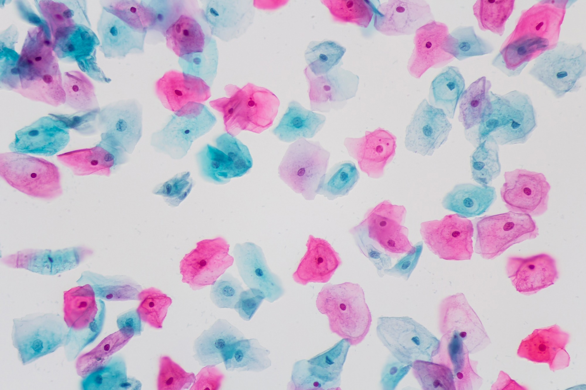 Squamous epithelial cells