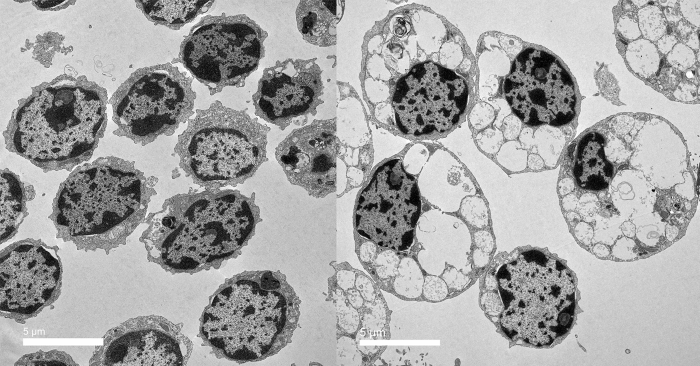 microglia cells