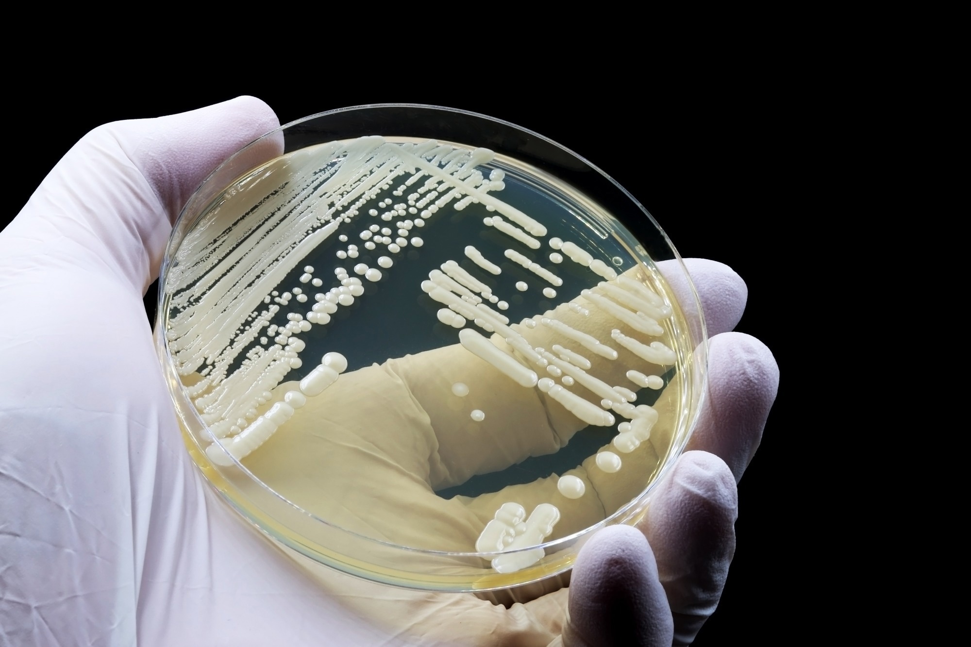 hand holding candida grown in the lab