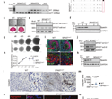 Primate-Specific DNA Change Reveals a New Link to Dementia-Related Neurodegeneration