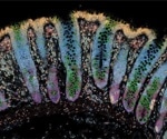 Researchers Identify Early Molecular Warning Signs of Inflammatory Bowel Disease