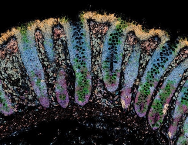 Researchers Identify Early Molecular Warning Signs of Inflammatory Bowel Disease