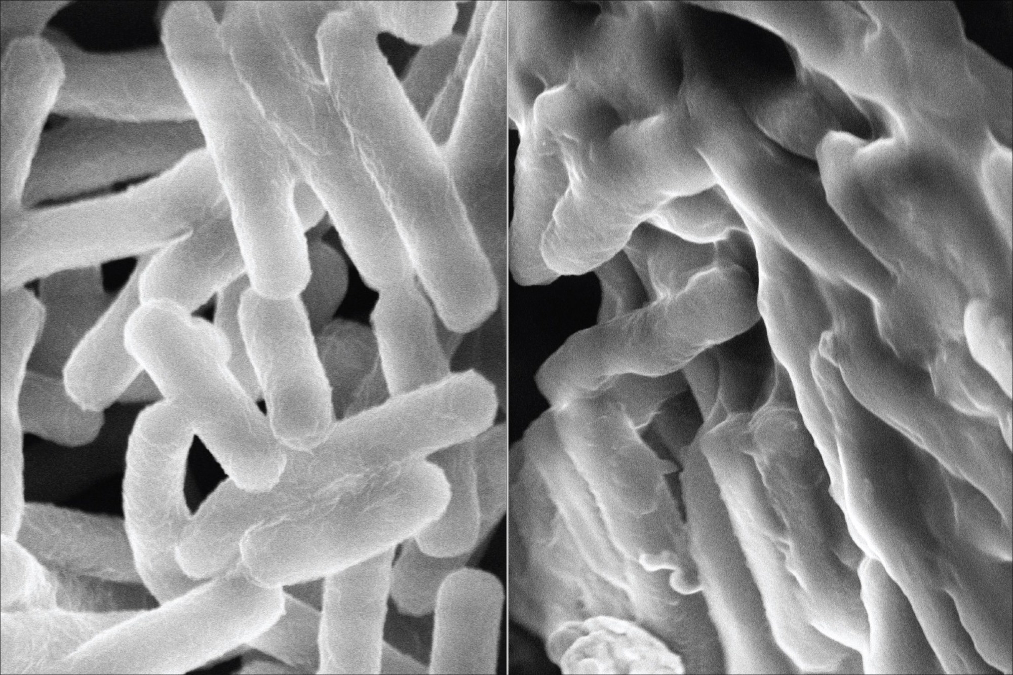AI-Designed Synthetic Polymers Mimic Natural Peptides to Beat Superbug Resistance