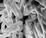 AI-Designed Synthetic Polymers Mimic Natural Peptides to Beat Superbug Resistance