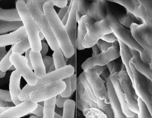 AI-Designed Synthetic Polymers Mimic Natural Peptides to Beat Superbug Resistance