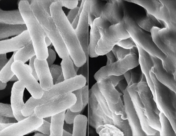 AI-Designed Synthetic Polymers Mimic Natural Peptides to Beat Superbug Resistance