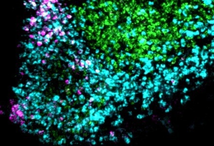 A fluorescent microscope image of brain tissue reveals cellular activity that is helping researchers better understand how the brain uses energy