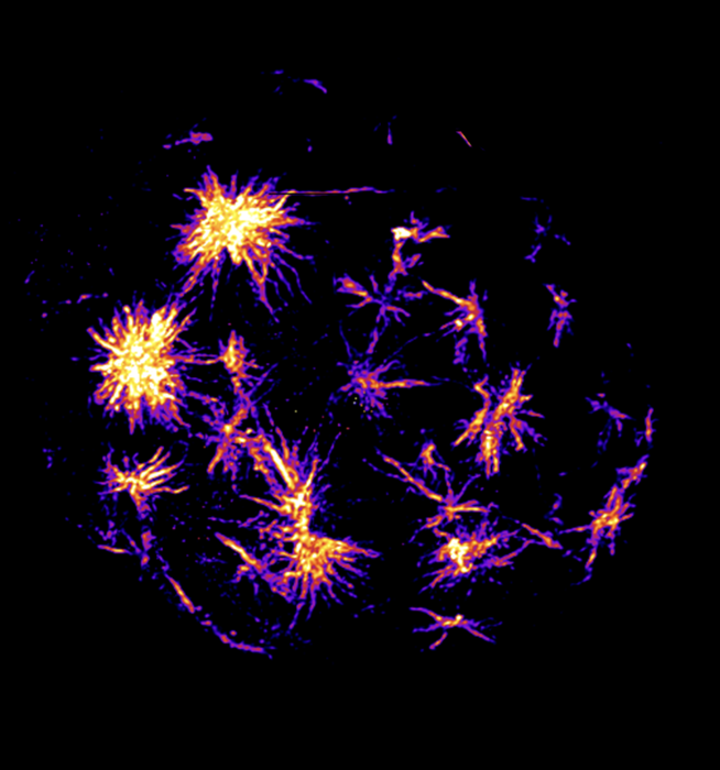A human cell showing light-induced clustering of Aurora A, which induces the formation of multiple microtubule-organising centres