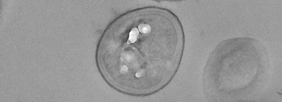 Thicker Bacterial Envelopes Impair Antibiotic Penetration During Active Mastitis Treatment