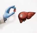 Could mRNA Vaccine Technology Help Repair Damaged Livers?