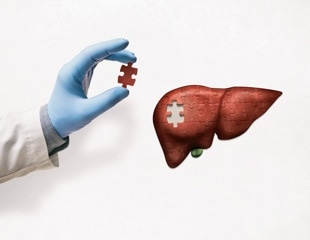 Could mRNA Vaccine Technology Help Repair Damaged Livers?
