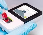 Fluidlab; Combining Cell Counting and Spectrometry to Improve Fluid Analysis