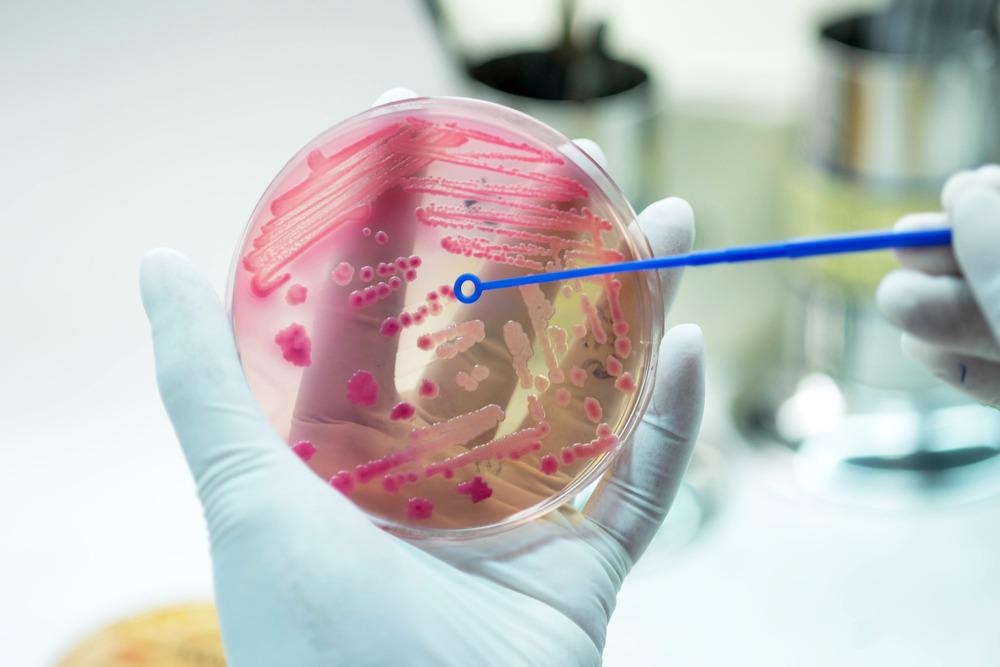 Antimicrobial resistance