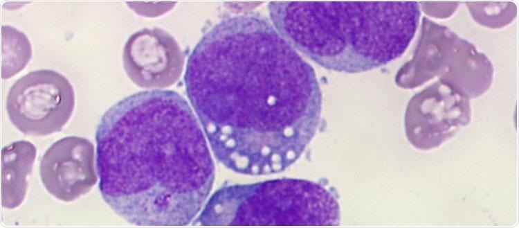 Experts trigger apoptosis in leukemia cells by disrupting their energy maintenance mechanism Experts trigger apoptosis in leukemia cells by disrupting their energy maintenance mechanism