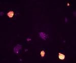 Research highlights the factors needed to reprogramme naïve pluripotent stem cells