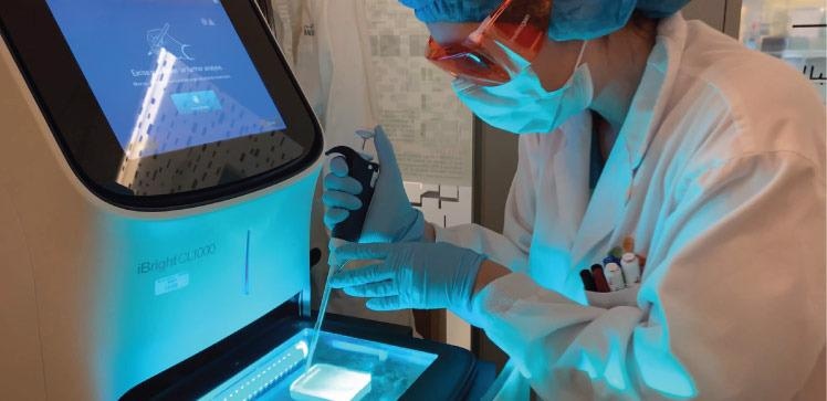 Study explores that extra dosages of genes may lead to surplus X chromosomes