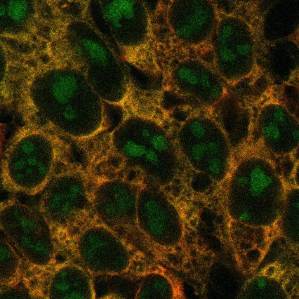 Researchers determine major protein complexes that cause ribosome production