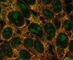 Researchers determine major protein complexes that cause ribosome production