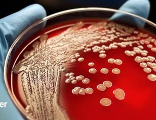 Researchers discover a unique technique to fight hospital-borne disease