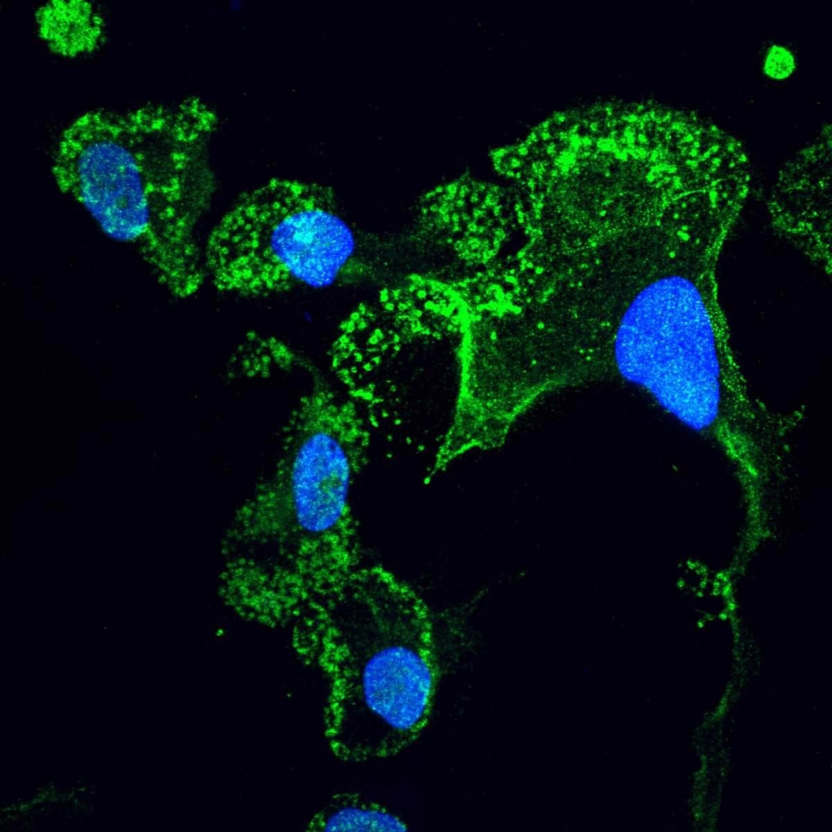 Noncoding DNA mutations prevent the brain from amyotrophic lateral sclerosis