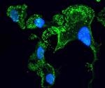 Noncoding DNA mutations prevent the brain from amyotrophic lateral sclerosis