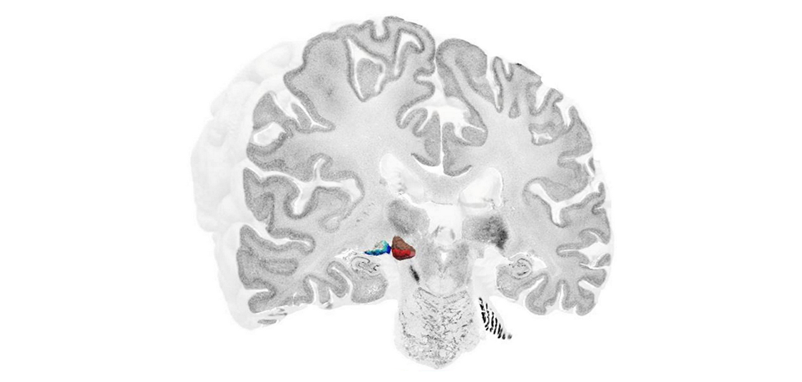 High-resolution 3D map reveals cellular structure of the human metathalamus